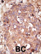 Anti-NUB1 Rabbit Polyclonal Antibody