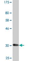 Anti-SLC6A11 Mouse Monoclonal Antibody [clone: 2C3]