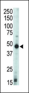 Anti-PRKAR1B Rabbit Polyclonal Antibody (AP (Alkaline Phosphatase))