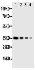 Anti-PKR Rabbit Polyclonal Antibody