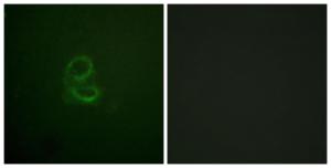 Immunofluorescence analysis of A549 cells using Anti-IL-4RAntibody. The right hand panel represents a negative control, where the antibody was pre-incubated with the immunising peptide.