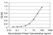 Anti-UBTF Mouse Monoclonal Antibody [clone: 1A2]