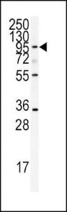 Anti-ADAMTS13 Rabbit Polyclonal Antibody (PE (Phycoerythrin))