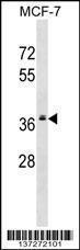 Anti-MRPL2 Rabbit Polyclonal Antibody (HRP (Horseradish Peroxidase))