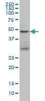 Anti-TSG101 Mouse Monoclonal Antibody [clone: 5B7]