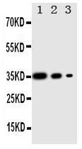 Anti-PERK Rabbit Polyclonal Antibody