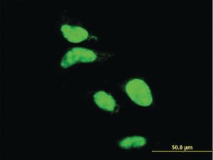 Anti-AATF Mouse Monoclonal Antibody [clone: 2H6]