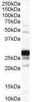 Anti-COMT Goat Polyclonal Antibody