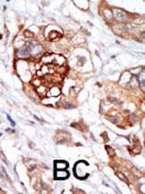 Anti-TTK Rabbit Polyclonal Antibody