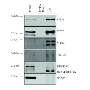 Immunoprecipitation analysis of mouse embryonic fibroblast using Anti-VPS35 Antibody [7E4] (A305036)