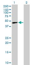 Anti-TREX1 Mouse Polyclonal Antibody