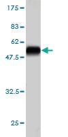 Anti-PSMB6 Mouse Monoclonal Antibody [clone: S51]