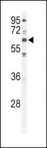 Anti-PRKCI Rabbit Polyclonal Antibody (AP (Alkaline Phosphatase))