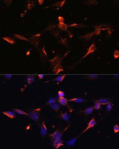 Immunofluorescence analysis of NIH/3T3 cells using Anti-Claudin 5 Antibody (A8552) at a dilution of 1:100. DAPI was used to stain the cell nuclei (blue)