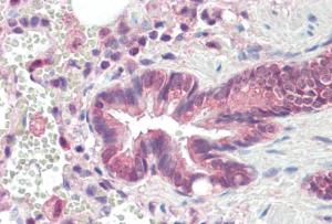 Anti-PSMB3 Antibody (A84864) (10 µg/ml) staining of paraffin embedded Human Lung. Steamed antigen retrieval with citrate buffer pH 6, AP-staining