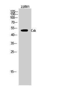 Western blot analysis of 22RV1 cells using Anti-CSK Antibody