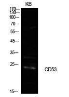 Western blot analysis of extracts from KB cells using Anti-CD53 Antibody