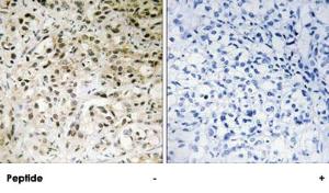 Anti-TAF5 Rabbit Polyclonal Antibody