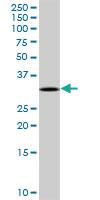 Anti-TREX1 Rabbit Polyclonal Antibody