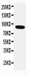 Anti-VRL1 Rabbit Polyclonal Antibody