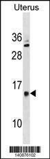 Anti-GALNTL5 Rabbit Polyclonal Antibody (AP (Alkaline Phosphatase))