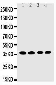 Anti-EIF2S1 Rabbit Polyclonal Antibody