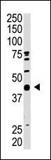 Anti-SAE1 Rabbit Polyclonal Antibody