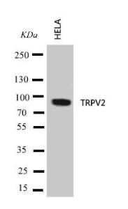 Anti-VRL1 Rabbit Polyclonal Antibody