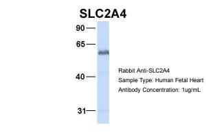 Anti-SLC2A4 Rabbit Polyclonal Antibody