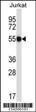 Anti-CNOT2 Rabbit Polyclonal Antibody (Biotin)