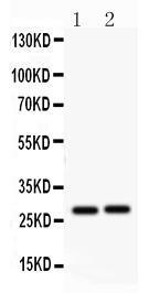 Anti-IGFBP1 Antibody