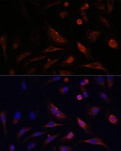 Immunofluorescence analysis of U2OS cells using Anti-Claudin 5 Antibody (A8552) at a dilution of 1:100. DAPI was used to stain the cell nuclei (blue)