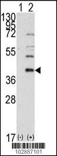 Anti-SAE1 Rabbit Polyclonal Antibody