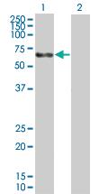 Anti-AFP Mouse Polyclonal Antibody