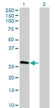 Anti-TPRG1L Mouse Polyclonal Antibody