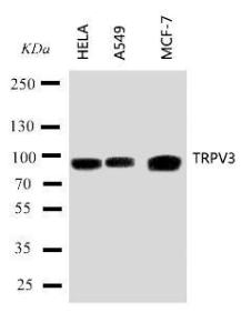 Anti-TRPV3 Rabbit Polyclonal Antibody