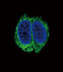 Anti-TGFBR2 Rabbit Polyclonal Antibody (PE (Phycoerythrin))