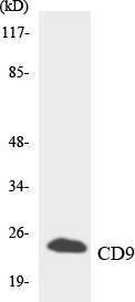 Western blot analysis of the lysates from 293 cells using Anti-CD9 Antibody