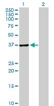 Anti-ABT1 Mouse Polyclonal Antibody