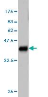 Anti-ALAS1 Mouse Monoclonal Antibody [clone: 3G10]