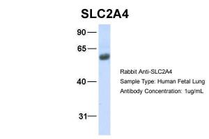 Anti-SLC2A4 Rabbit Polyclonal Antibody