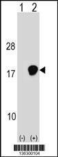 Anti-UBE2D3 Rabbit Polyclonal Antibody (AP (Alkaline Phosphatase))