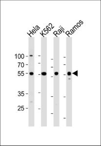 Anti-RELA Rabbit Polyclonal Antibody (PE (Phycoerythrin))