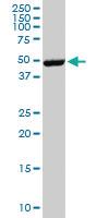 Anti-EPOR Mouse Monoclonal Antibody [clone: 3F6]