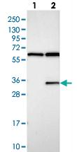 Anti-GTPBP8 Rabbit Polyclonal Antibody