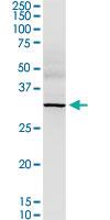 Anti-TREX1 Rabbit Polyclonal Antibody