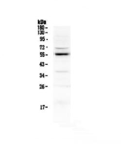 EPO Receptor primary antibodies WB testing 1