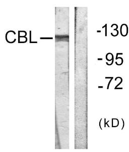 Western blot analysis of lysates from HepG2 cells, treated with Na2VO3 0.3nM 40' using Anti-CBL Antibody. The right hand lane represents a negative control, where the antibody is blocked by the immunising peptide.