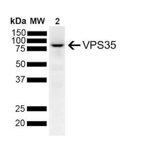 Western blot analysis of human SH-SY5Y lysates showing detection of 917 kDa VPS35 protein using Anti-VPS35 Antibody [7E4] (A305036) at 1:1,000 for 2 hours at room temperature with shaking Lane 1: Molecular Weight Ladder Lane 2: SH-SY5Y Load: 10 Î¼g Block: 5% Skim Milk powder in TBST