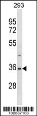 Anti-SAE1 Rabbit Polyclonal Antibody